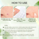 Invisible Acne Patches · 36PCS – Skin Care, product detail 8